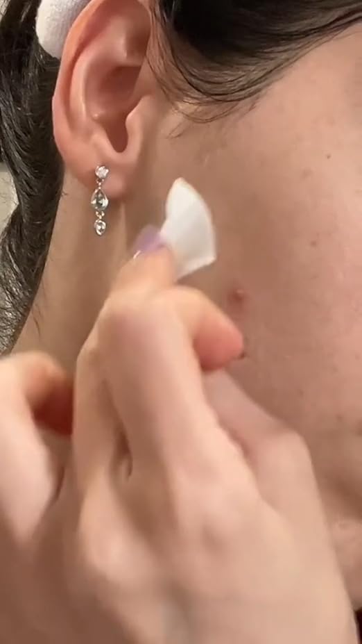 Micro Needle Acne Patches